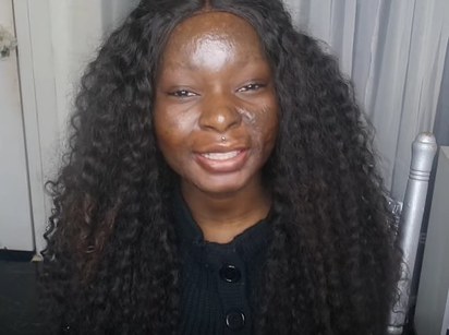 Chica sobreviviente a quemaduras es una artista del maquillaje en youtube