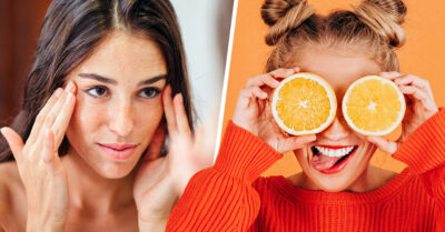 El secreto contra las manchas de tu cara es la Vitamina C