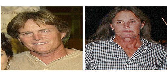 bruce jenner