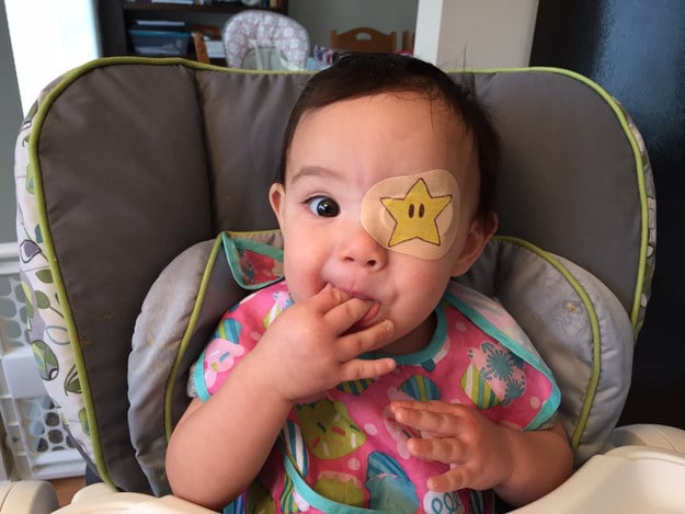 niña usando un parche en el ojo con forma de estrella 