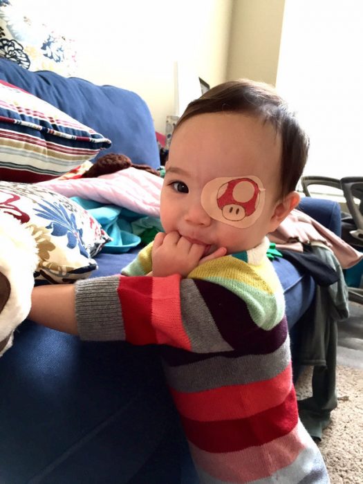 niña usando un parche en el ojo en forma de hongo 