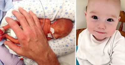 Esta es la asombrosa historia de un BEBÉ que iba ser ABORTADO ¡Ya cumplió un año!