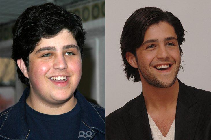 El antes y el después de Josh Peck 