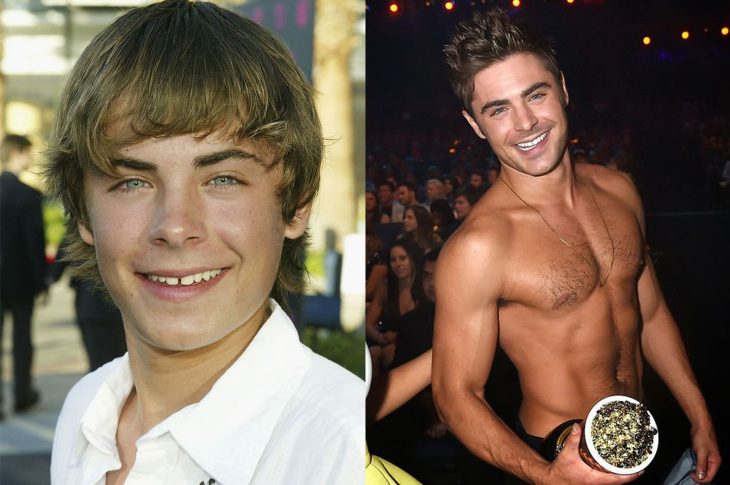 El antes y el después de Zac Efron 