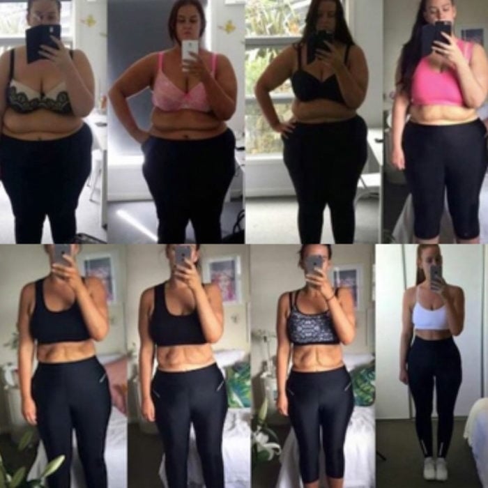 Mujer antes y después de perder peso