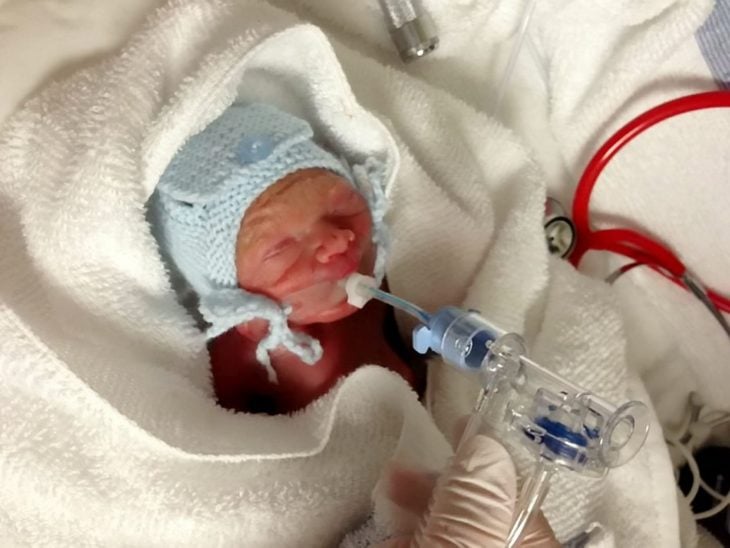 Bebé conectado a tubos para que pudiera respirar 