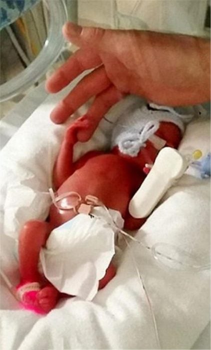 Bebé tomando la mano de su papá mientras esta conectado a un respirador artificial 