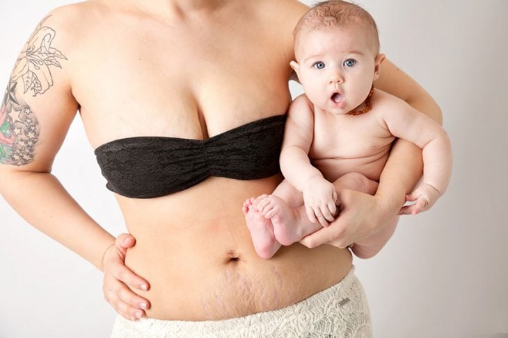 mujer cargando sobre su cadera a un bebé y mostrando su abdomen 