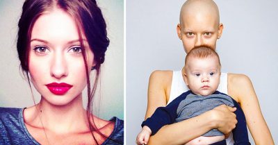 Los médicos le dijeron que ABORTARA tras perder el 95% de su mandíbula por el CÁNCER, ella respondió así