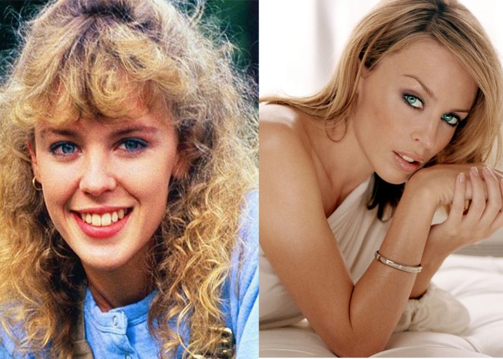  Kylie Minogue antes cuando era adolescente y después de adulta