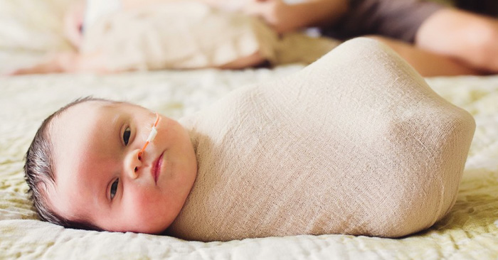 Esta bebé tiene un tumor cerebral inoperable, así que sus padres hicieron una sesión de fotos para demostrarle su amor