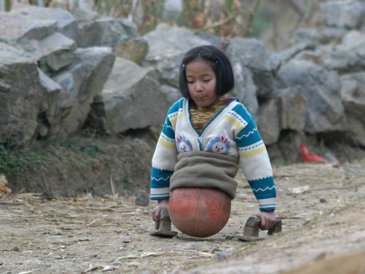 La chica baloncesto caminando con ayuda de un par de maderas 