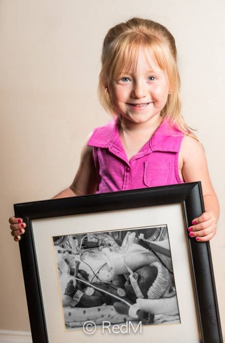 niña sosteniendo una imagen de cuando era una bebé prematura
