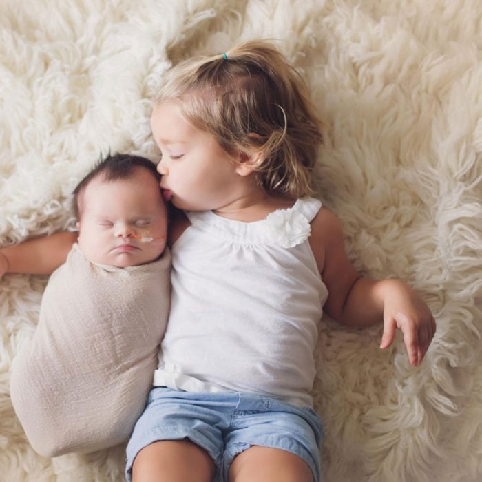 sesión de fotos de una bebé que nació con un tumor en el cerebro y síndrome de down recostada en una cama junto a su hermana 