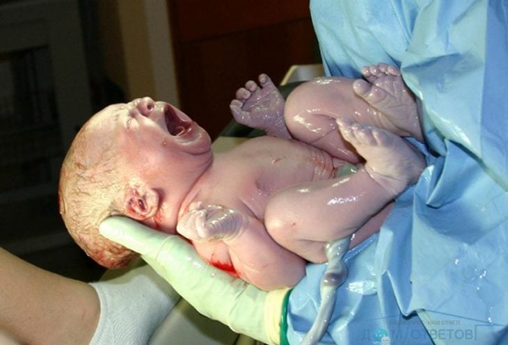 recién nacido aún con cordón umblical