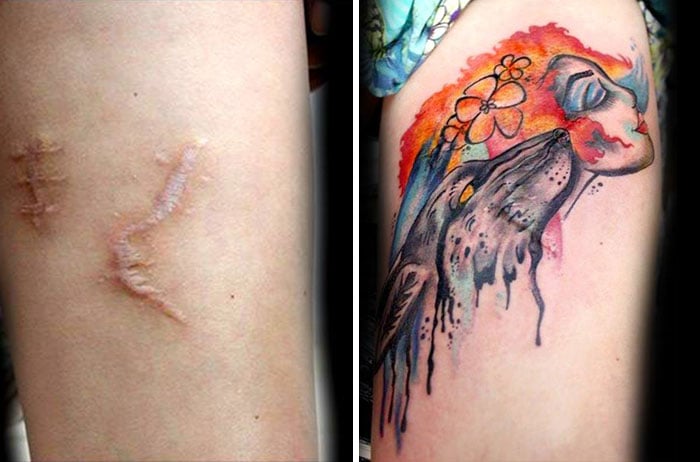 Cicatriz en el brazo cubierta por un tatuaje 
