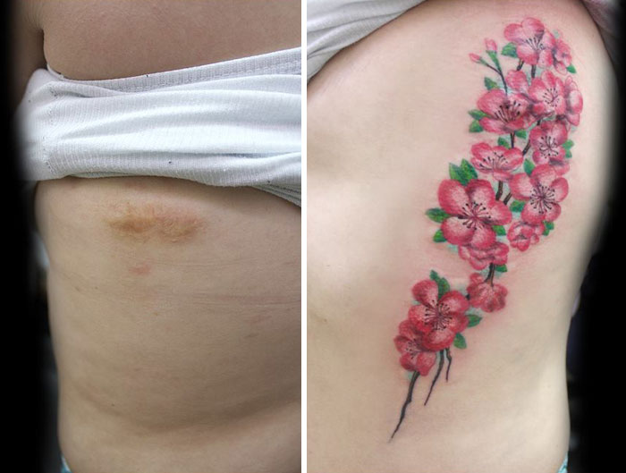 Cicatriz en el pecho de una mujer cubierta por un tatuaje de flores color rosa 