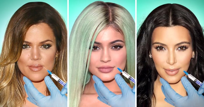 Kardashians se transforman con cirugías plasticas