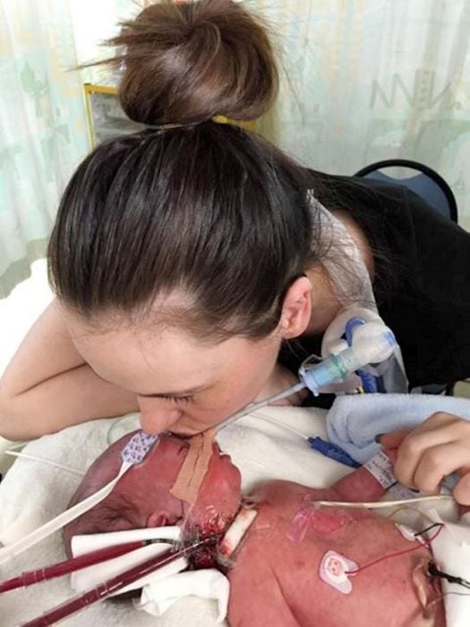El último beso de una madre a su bebé que sufria de una rara enfermedad pulmonar 