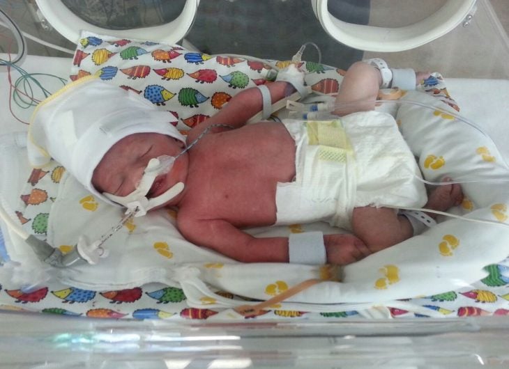 Bebé en una incubadora que lo mantenía con vida 
