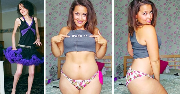 Chica que se salvó de morir a causa de la anorexia, muestra en Instagram su nueva y recuperada figura