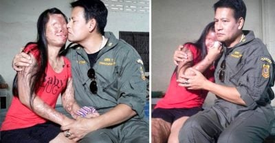 Ella quedó marcada por un terrible accidente. Él le mostró al mundo el verdadero significado del amor