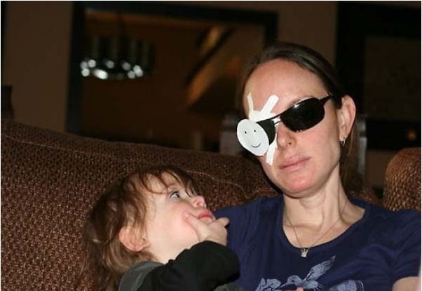 Mamá sosteniendo a su hijo con un parche en el ojo 