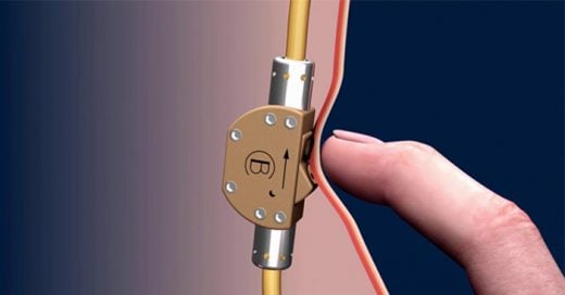 Adiós vasectomía: Este invento permite al hombre apagar y prender su fertilidad con un interruptor