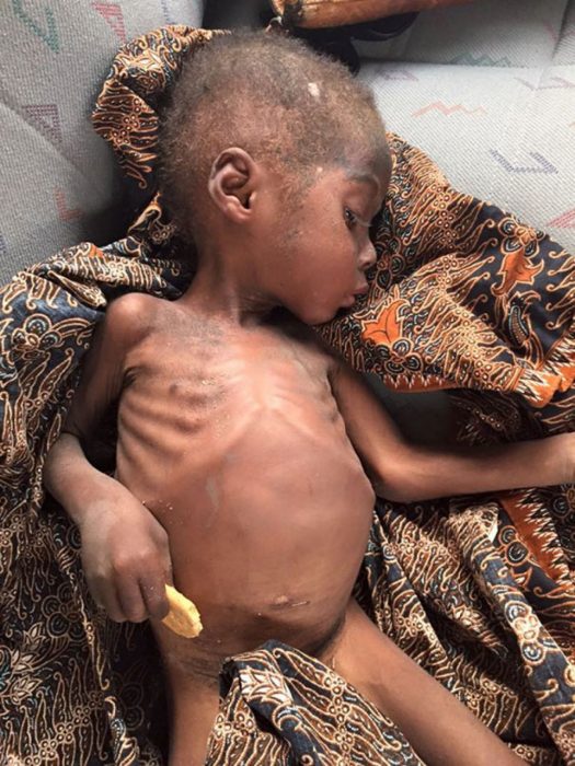 Hope el niño que fue rescatado en nigeria 