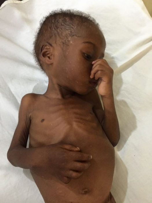 Niño rescatado en Nigeria después de ser abandonado 