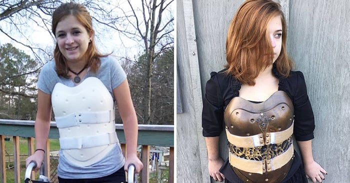 Chica transforma su corsé ortopédico en una armadura