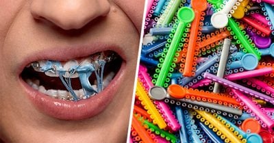 20 Cosas que sólo las chicas que han usado brackets podrán entender