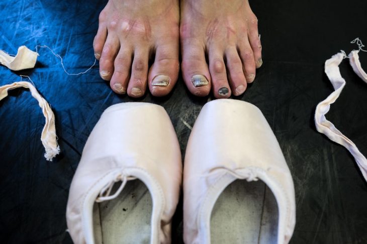 Pies desgastados de una Bailarina de ballet