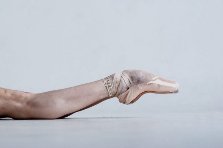 Pies de una bailarina de ballet maltratados con moretones