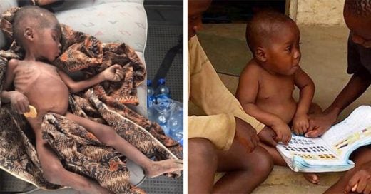 Conoce la historia de ‘Hope’, el niño desnutrido rescatado de África