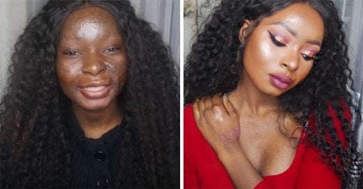 Mujer sobreviviente de quemaduras es una gran artista del maquillaje