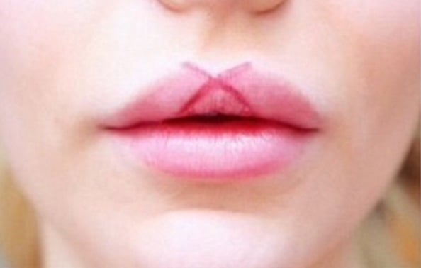 secreto para volumen en los labios