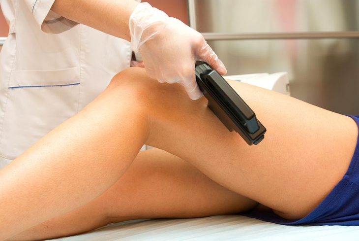 piernas acostadas con maquina laser 