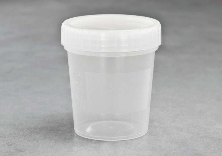 bote para muestra de esperma
