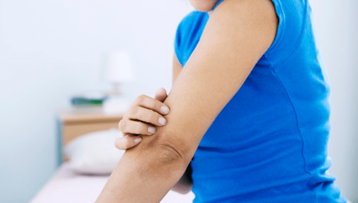 mujer con playera azul y codos manchados 