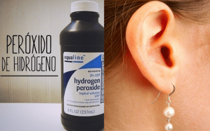 peroxido de hidrogeno y oreja con arete colgando 