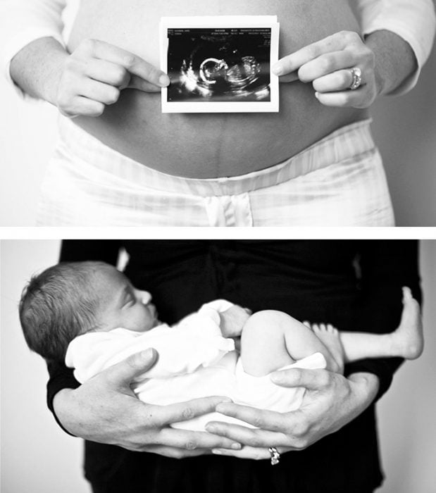 Foto de ultrasonido, foto de bebé 