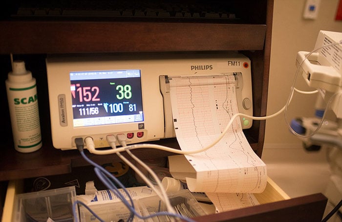aparato para medir frecuencia cardiaca