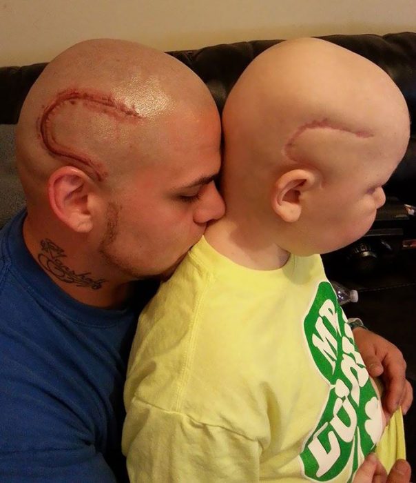 Josh y Gabriel Marshall padre con tatuaje de cicatriz de hijo