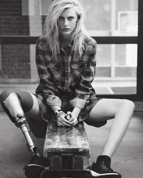 Modelo Lauren Wasser que perdió la pierna a causa de un tampón sentada sobre una banca mientras posa para una fotografía 