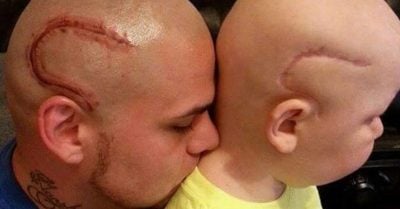 ¡El papá del año! Este padre se hizo un tatuaje de la cicatriz de su hijo para hacerlo sentir mejor