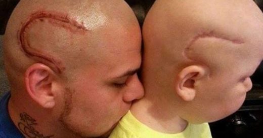 Padre se tatúa la cicatriz de operación de su hijo para alimentar su confianza