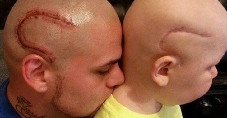Padre se tatúa la cicatriz de operación de su hijo para alimentar su confianza