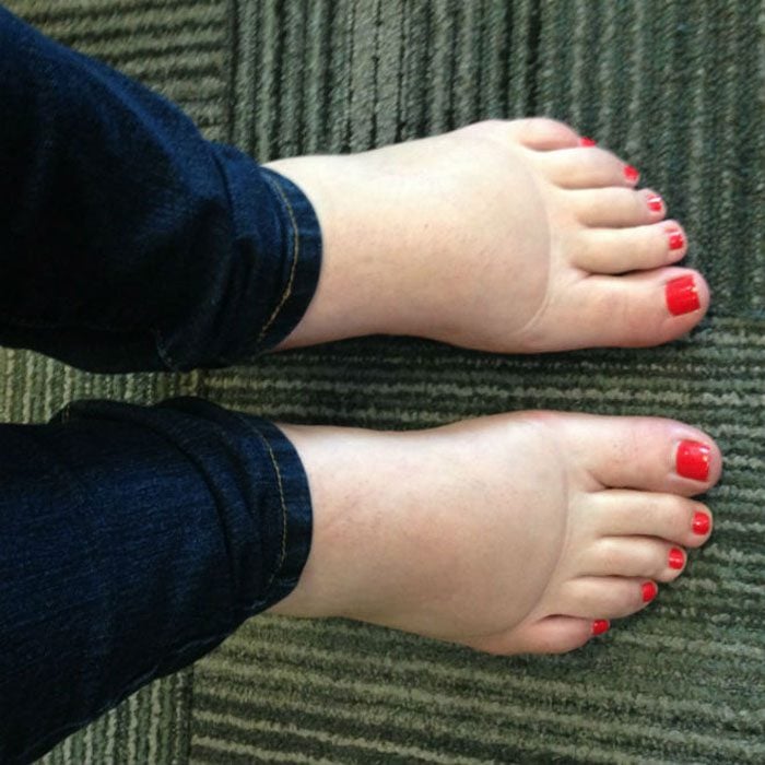 Место для ног в самолете. Ступни стюардесс. Ступни в самолете. Отекли ноги после перелета в самолете. Стоячие места в самолете.