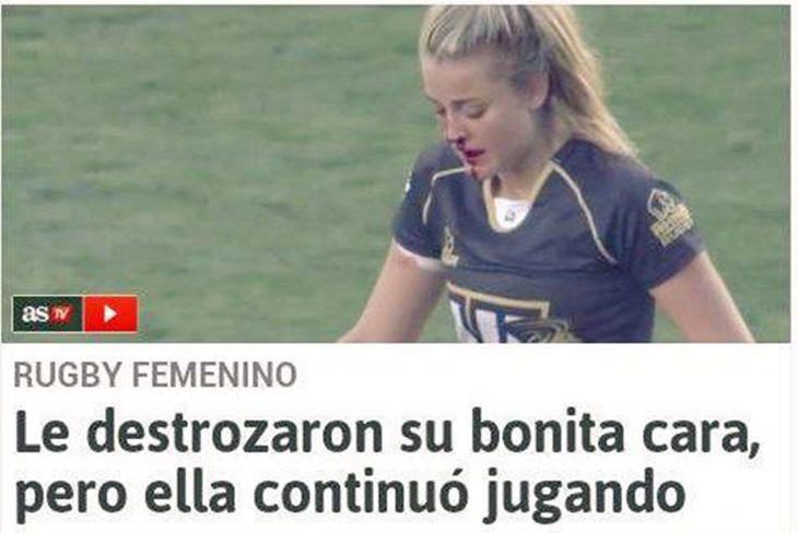 noticia de revista digital con jugadora rubia con sangre en la cara 